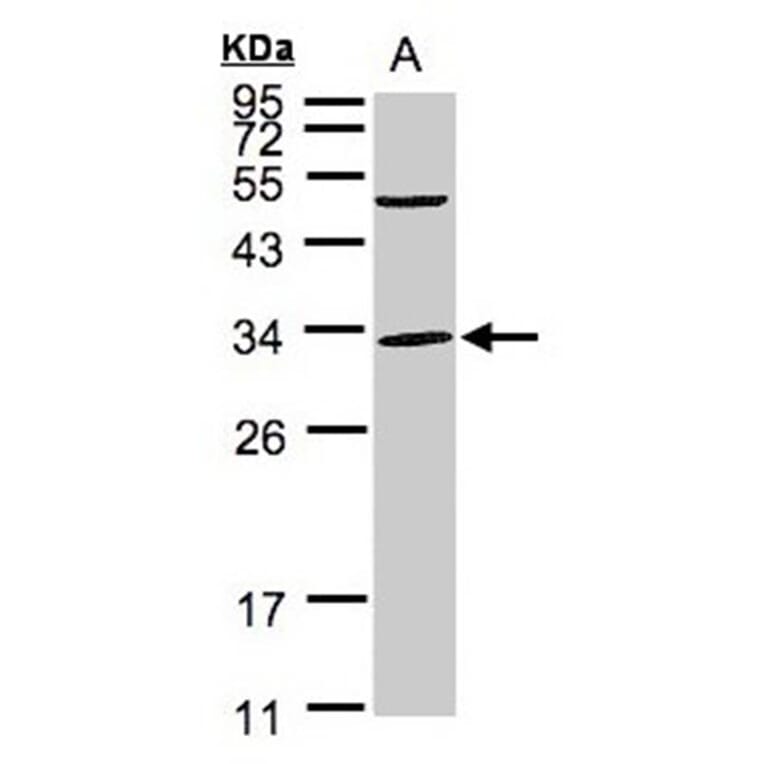 Peflin antibody from Signalway Antibody (22097) - Antibodies.com