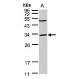 Peflin antibody from Signalway Antibody (22097) - Antibodies.com