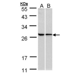 RPL13A antibody from Signalway Antibody (22135) - Antibodies.com
