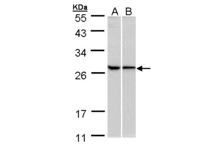 RPL13A antibody from Signalway Antibody (22135) - Antibodies.com