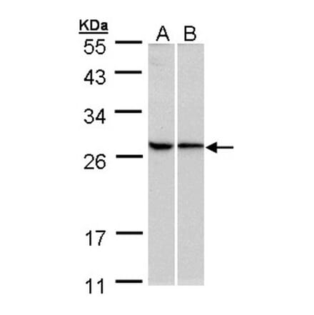 RPL13A antibody from Signalway Antibody (22135) - Antibodies.com