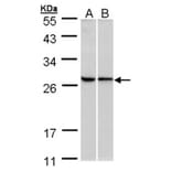 RPL13A antibody from Signalway Antibody (22135) - Antibodies.com