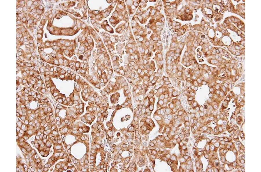 Immunohistochemistry - RPL13A antibody from Signalway Antibody (22135) - Antibodies.com
