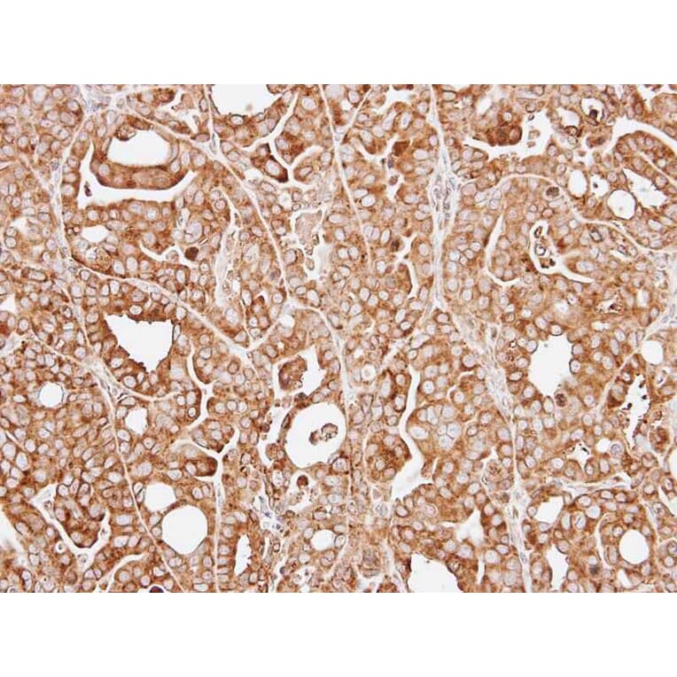 Immunohistochemistry - RPL13A antibody from Signalway Antibody (22135) - Antibodies.com