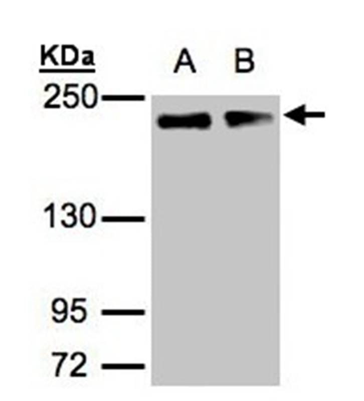 Sample (30 µg of whole cell lysate) A431B: H12995% SDS PAGE Primary antibody diluted at 1: 1000