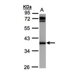 AKR1C1 antibody from Signalway Antibody (22149) - Antibodies.com