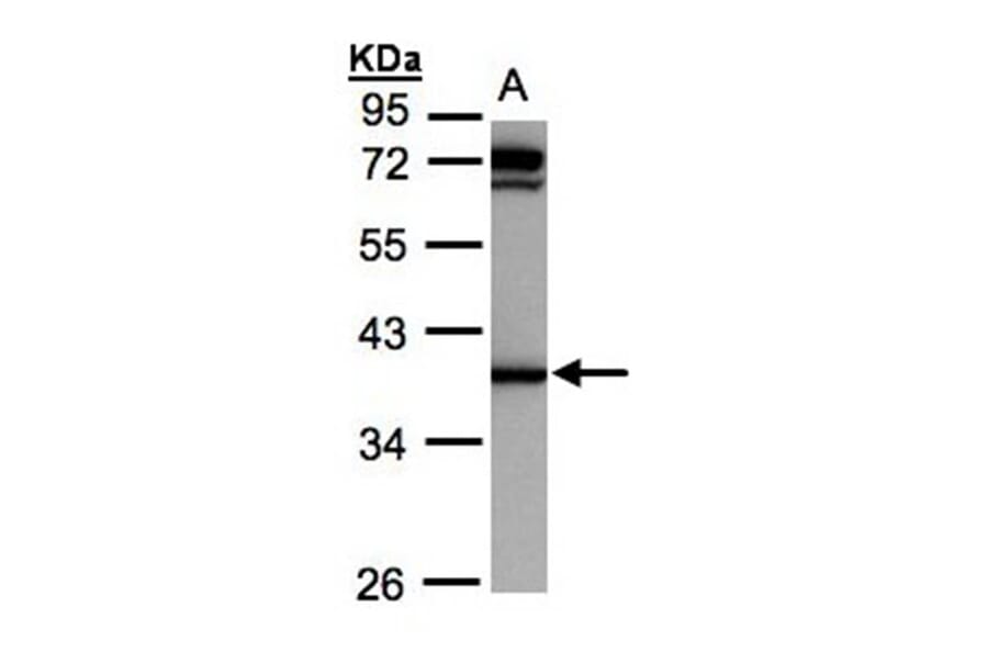 AKR1C1 antibody from Signalway Antibody (22149) - Antibodies.com