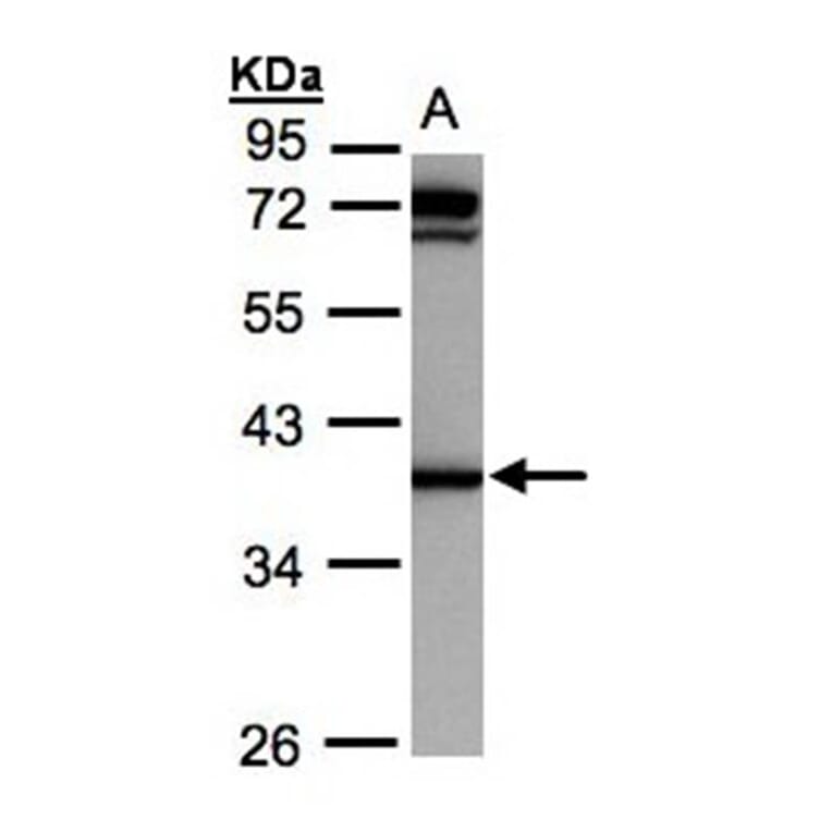 AKR1C1 antibody from Signalway Antibody (22149) - Antibodies.com