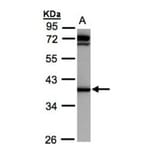 AKR1C1 antibody from Signalway Antibody (22149) - Antibodies.com