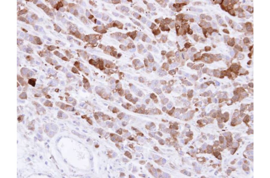 Immunohistochemistry - AKR1C1 antibody from Signalway Antibody (22149) - Antibodies.com