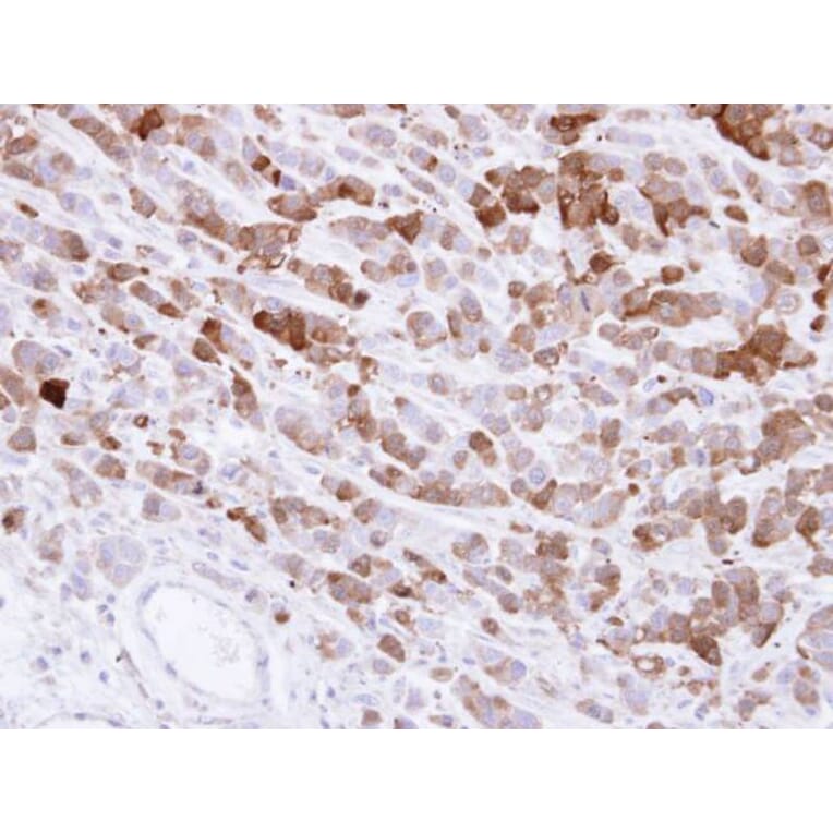 Immunohistochemistry - AKR1C1 antibody from Signalway Antibody (22149) - Antibodies.com