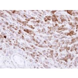 Immunohistochemistry - AKR1C1 antibody from Signalway Antibody (22149) - Antibodies.com