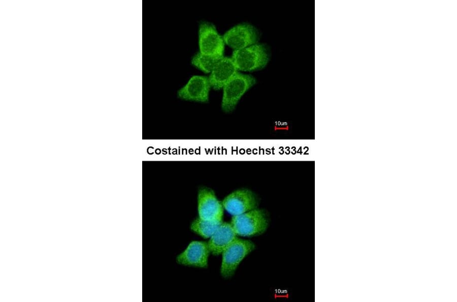 Immunofluorescence - AKR1C1 antibody from Signalway Antibody (22149) - Antibodies.com