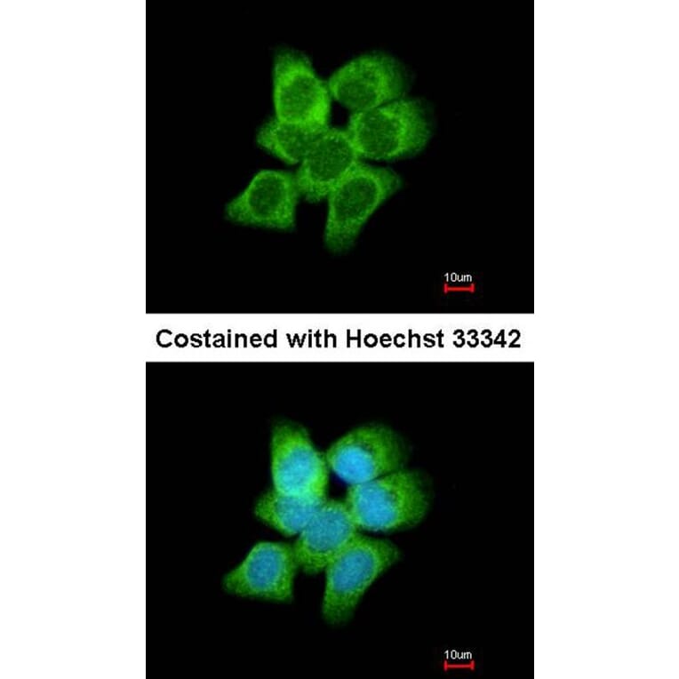 Immunofluorescence - AKR1C1 antibody from Signalway Antibody (22149) - Antibodies.com