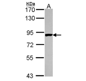 PNPase antibody from Signalway Antibody (22175) - Antibodies.com