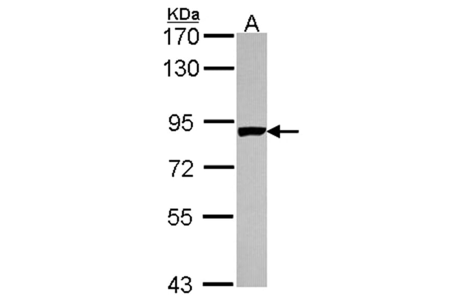 PNPase antibody from Signalway Antibody (22175) - Antibodies.com
