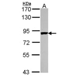 PNPase antibody from Signalway Antibody (22175) - Antibodies.com