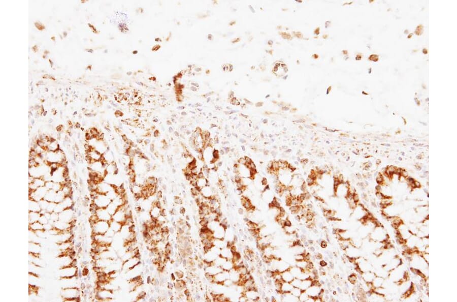 Immunohistochemistry - PNPase antibody from Signalway Antibody (22175) - Antibodies.com