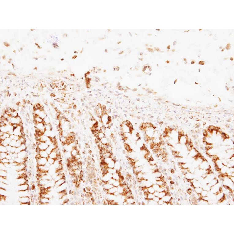 Immunohistochemistry - PNPase antibody from Signalway Antibody (22175) - Antibodies.com