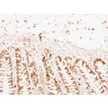 Immunohistochemistry - PNPase antibody from Signalway Antibody (22175) - Antibodies.com