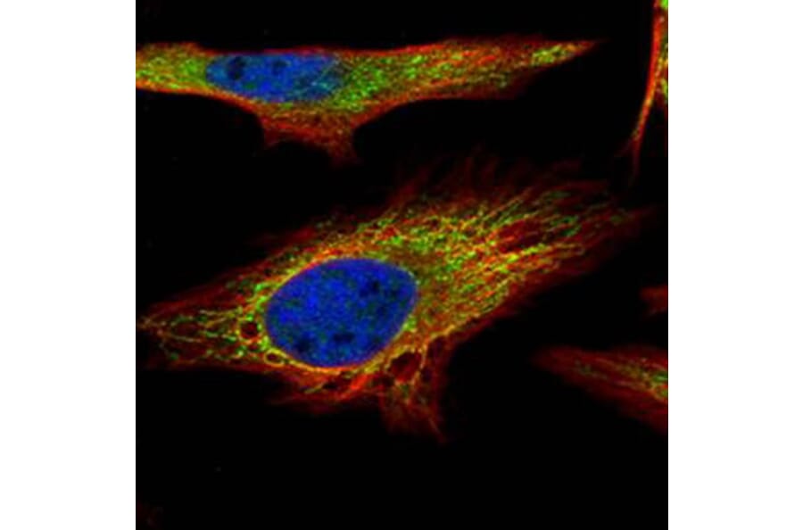 PNPase antibody from Signalway Antibody (22175) - Antibodies.com