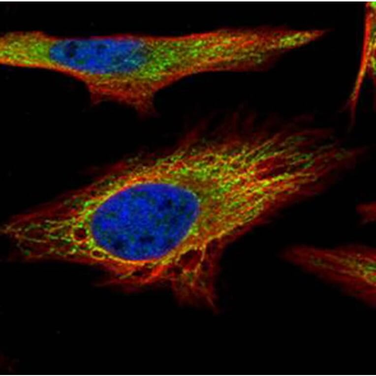 PNPase antibody from Signalway Antibody (22175) - Antibodies.com