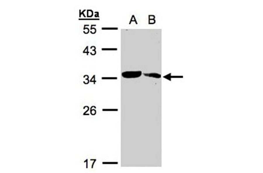 MMACHC antibody from Signalway Antibody (22182) - Antibodies.com