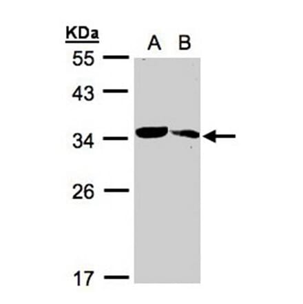 MMACHC antibody from Signalway Antibody (22182) - Antibodies.com