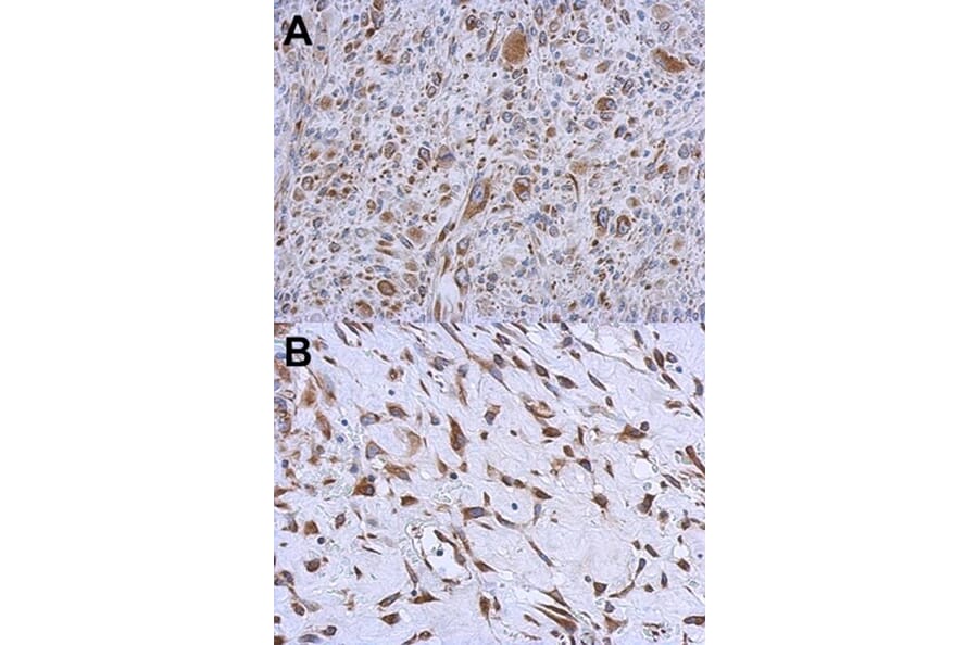Immunohistochemistry - MMACHC antibody from Signalway Antibody (22182) - Antibodies.com