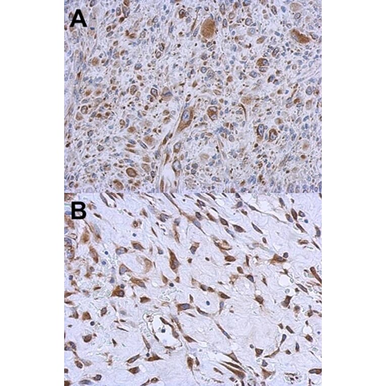 Immunohistochemistry - MMACHC antibody from Signalway Antibody (22182) - Antibodies.com