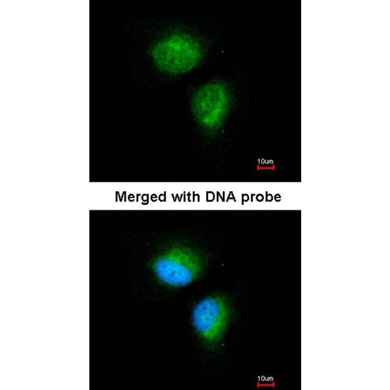 Immunofluorescence - MMACHC antibody from Signalway Antibody (22182) - Antibodies.com