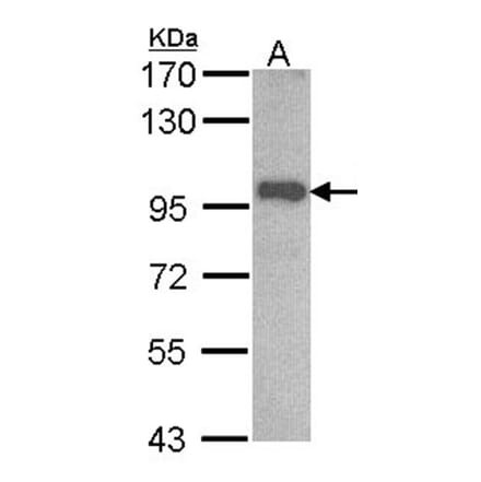 OSBPL6 antibody from Signalway Antibody (22195) - Antibodies.com