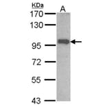 OSBPL6 antibody from Signalway Antibody (22195) - Antibodies.com