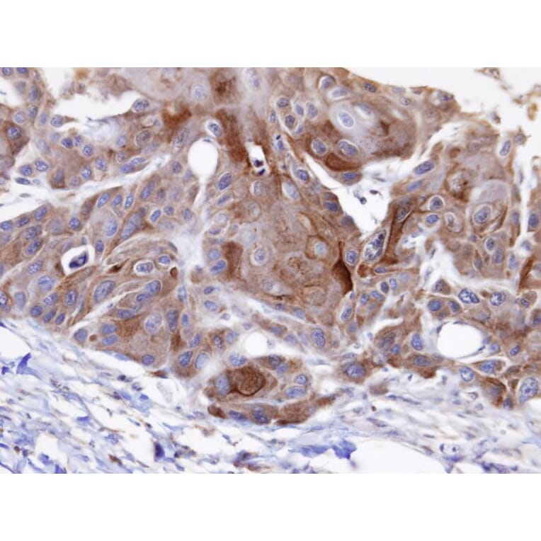 Immunohistochemistry - OSBPL6 antibody from Signalway Antibody (22195) - Antibodies.com