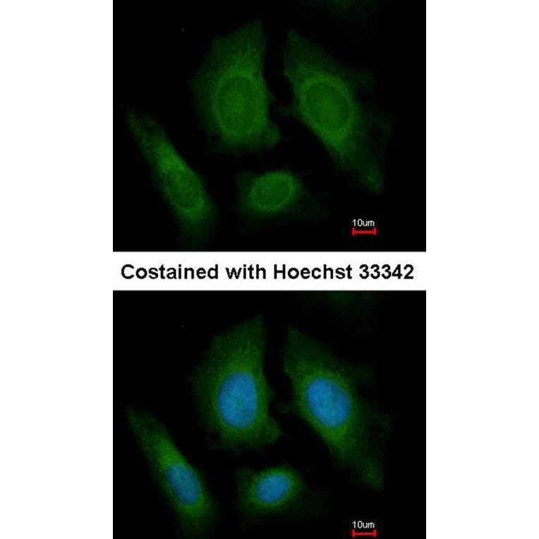 Immunofluorescence - OSBPL6 antibody from Signalway Antibody (22195) - Antibodies.com