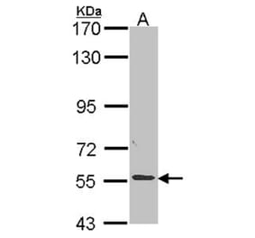ALPPL2 antibody from Signalway Antibody (22318) - Antibodies.com