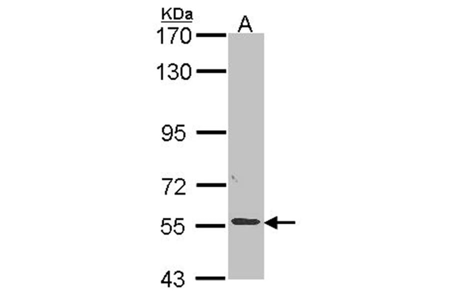 ALPPL2 antibody from Signalway Antibody (22318) - Antibodies.com