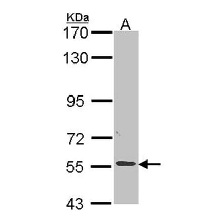ALPPL2 antibody from Signalway Antibody (22318) - Antibodies.com