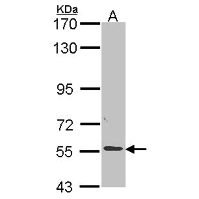 ALPPL2 antibody from Signalway Antibody (22318) - Antibodies.com