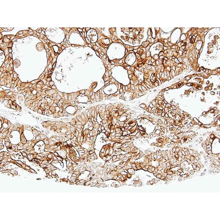 Immunohistochemistry - ALPPL2 antibody from Signalway Antibody (22318) - Antibodies.com
