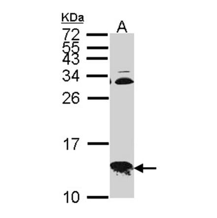 COX6B1 antibody from Signalway Antibody (22322) - Antibodies.com