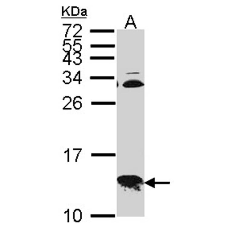 COX6B1 antibody from Signalway Antibody (22322) - Antibodies.com