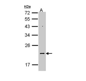 NDUFB5 antibody from Signalway Antibody (22342) - Antibodies.com