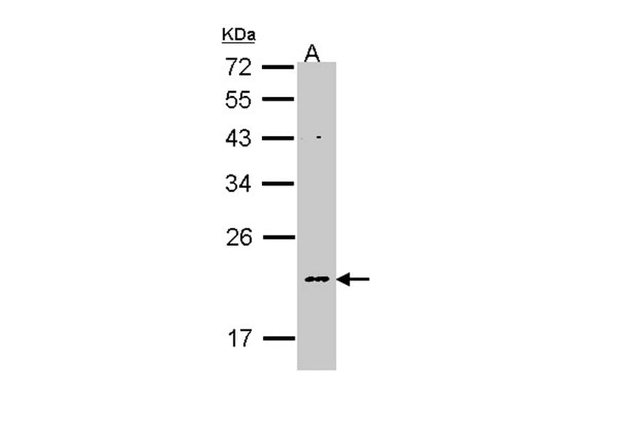 NDUFB5 antibody from Signalway Antibody (22342) - Antibodies.com