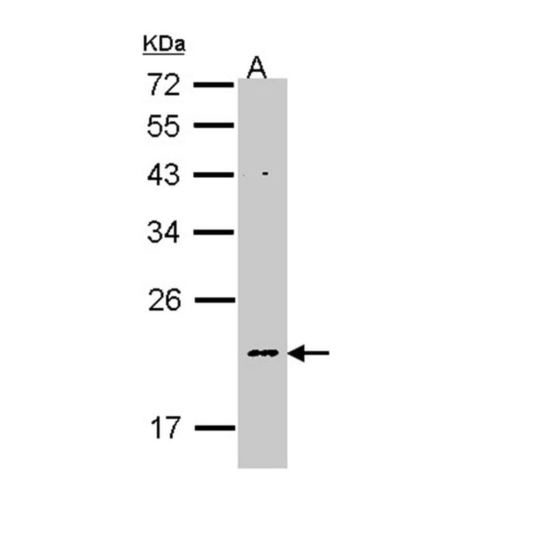 NDUFB5 antibody from Signalway Antibody (22342) - Antibodies.com