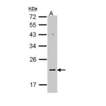 NDUFB5 antibody from Signalway Antibody (22342) - Antibodies.com