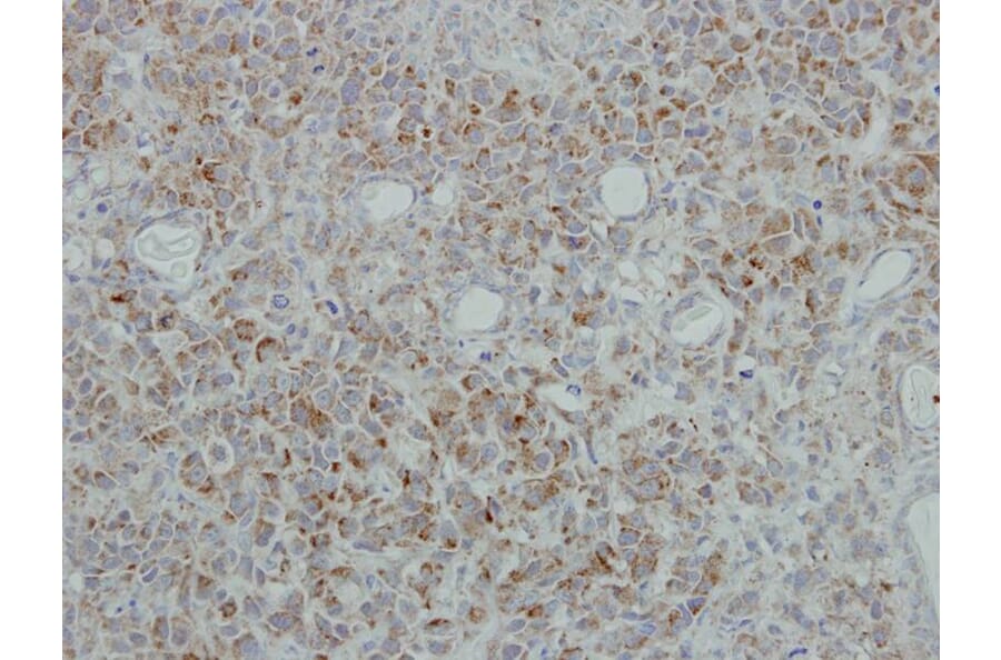 Immunohistochemistry - NDUFB5 antibody from Signalway Antibody (22342) - Antibodies.com