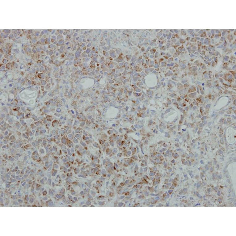 Immunohistochemistry - NDUFB5 antibody from Signalway Antibody (22342) - Antibodies.com