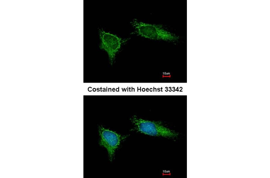 Immunofluorescence - NDUFB5 antibody from Signalway Antibody (22342) - Antibodies.com