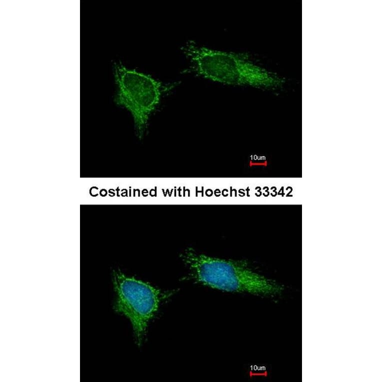 Immunofluorescence - NDUFB5 antibody from Signalway Antibody (22342) - Antibodies.com